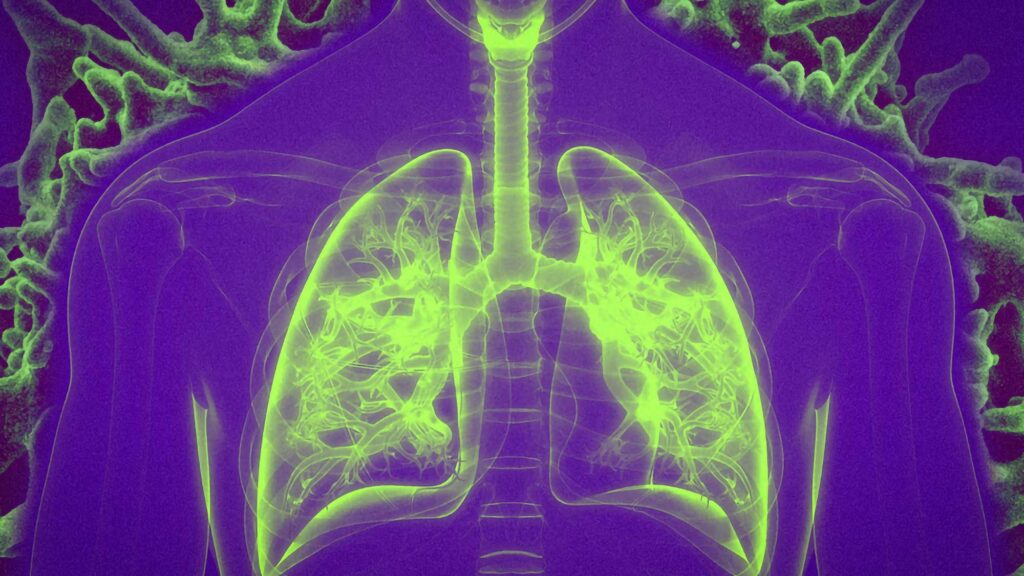 MIT Researchers Study Vaccination by Inhalation