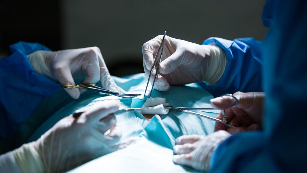 How To Recover From Bariatric Surgery: Top Things You Should Know