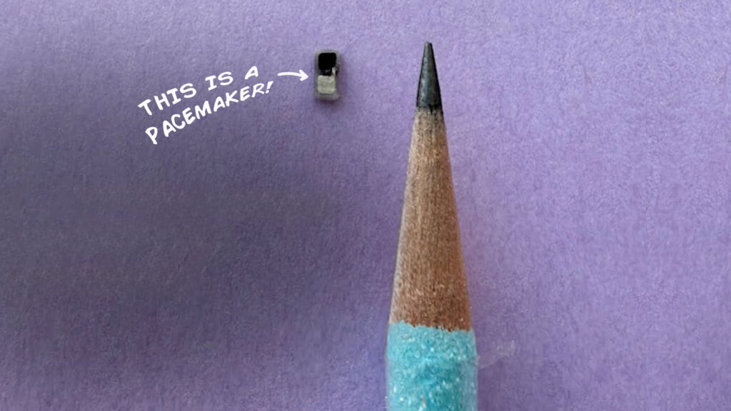 World’s Smallest Pacemaker by Northwestern University